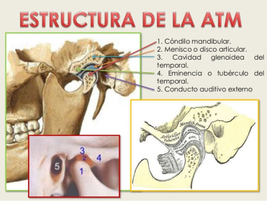 articulación temporo mandibular